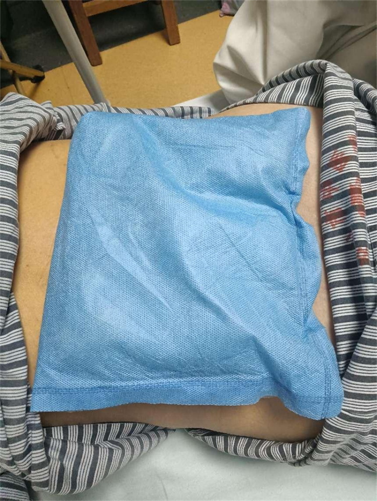 中藥熱奄包技術(shù)（干法）